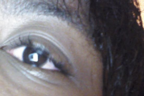 Picture of my red eye.